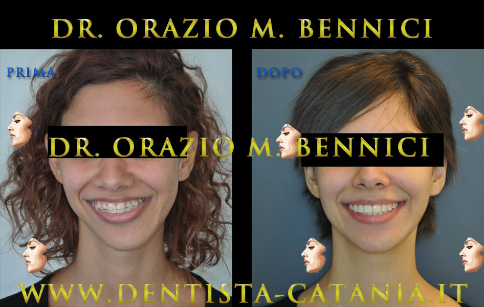 Caso clinico Ortodonzia 3