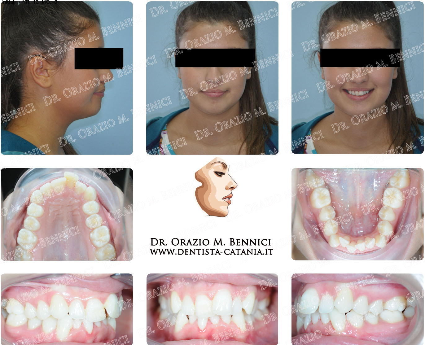 Caso clinico Ortodonzia 6